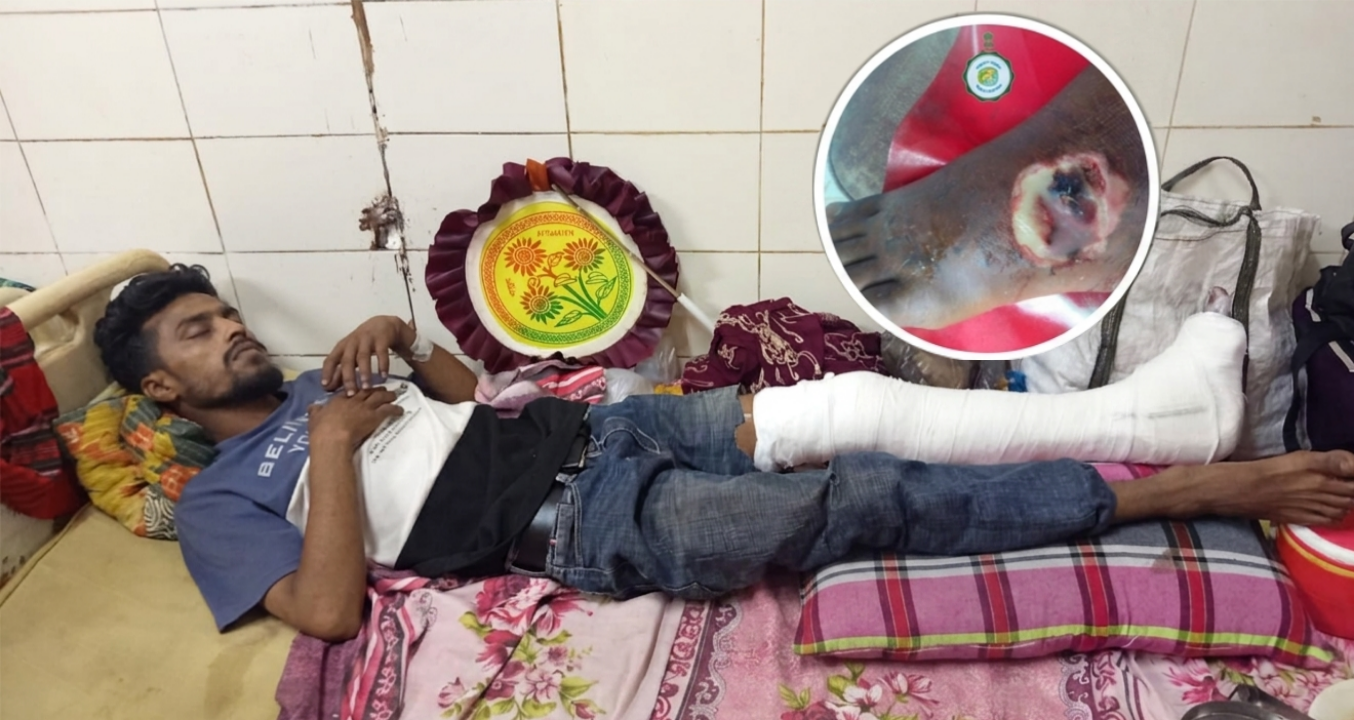দুর্ঘটনার কবলে পঙ্গুত্বের ঝুঁকিতে ফার্নিচারমিস্ত্রি সিপন: চিকিৎসা খরচ মেটাতে নিঃস্ব ভূমিহীন পরিবার