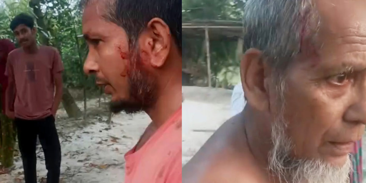 আদমদীঘিতে বাবাকে বাঁচাতে গিয়ে সাংবাদিক ছেলেও আহত, থানায় অভিযোগ
