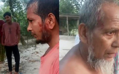 আদমদীঘিতে বাবাকে বাঁচাতে গিয়ে সাংবাদিক ছেলেও আহত, থানায় অভিযোগ